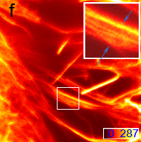 STED超分辨成像 · 肌动蛋白