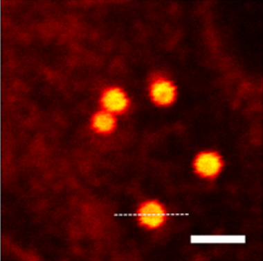 共聚焦成像 · 高尔基体