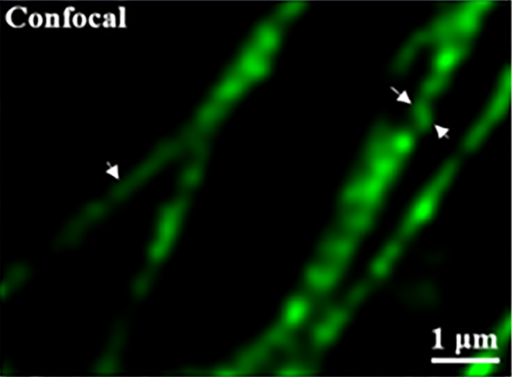 共聚焦成像 · 微管蛋白
